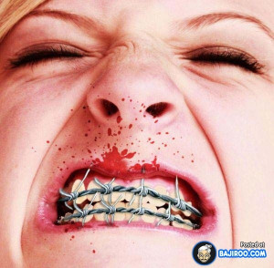 27 Pictures Of People With Funny Teeth Braces