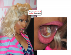 How about Nicki Minaj 's teeth ? Are they real or fake? Watching some ...