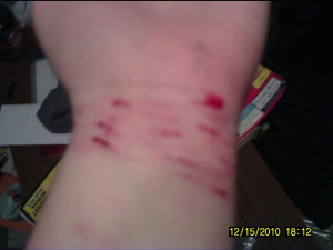 Do you Emo Cut your self