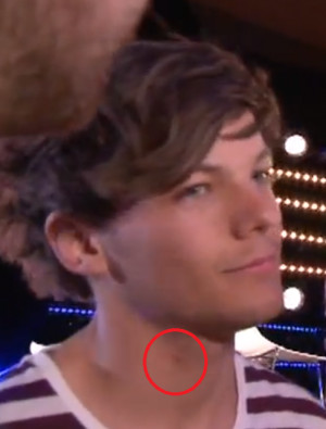 Guys With Hickeys Tumblr That louis has a hickey.