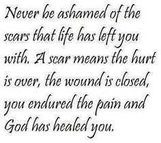 ... , Life, Inspiration, Wisdom, Scars, Favorite Quotes, Healing, Living