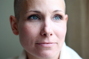 The scars of cancer are your badge of honor that are to be worn with ...