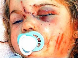 Even this is hard to watch. Imagine if it's a real kid.