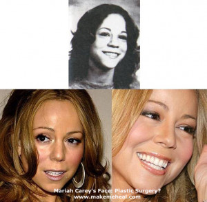 Thread: Mariah Carey's plastic surgery