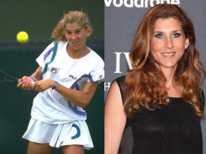 Steffi Graf Plastic Surgery Before and After Nose Job or Rhinoplasty