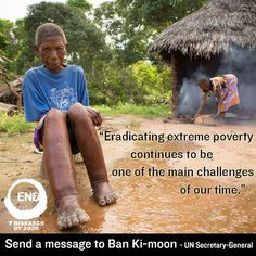 Help us end poverty and the suffering of millions by adding your name ...