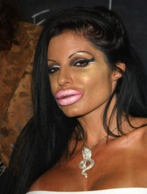 Plastic surgery gone horribly wrong (25 Photos)