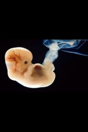 Pro life- this baby is so adorable:)