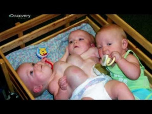 Photo : YouTube) Conjoined Twins Mackenzie and Macy Garrison were ...