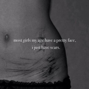 cut, girls, pretty face, quote, scars, self harm