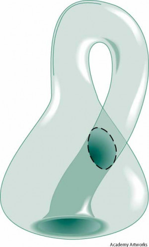 Klein bottle