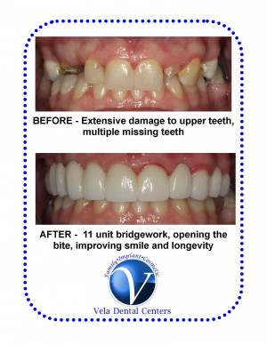 Vela Dental Center- Southside