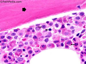 Normal Bone Marrow