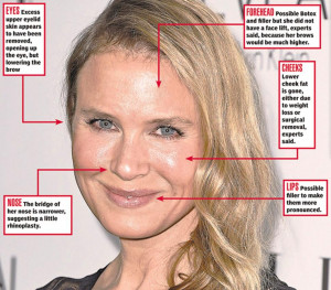 Renee Zellweger's new face: Plastic surgeons tell us what work the ...