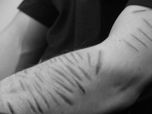 ... that there is an alarming rise in the number of people self harming
