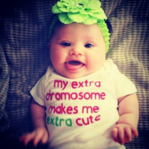 Down Syndrome, Baby Baby, Cutest Things, Adorable Baby, Extra ...