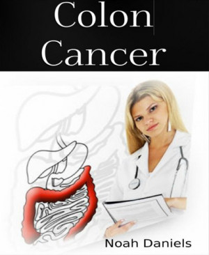 Colon Cancer