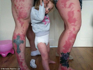 Parents get huge red tattoos on their legs to support their 18-month ...