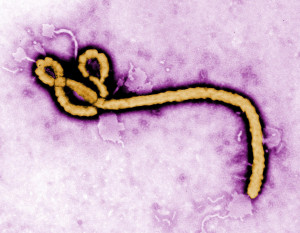 Image: Ebola virus