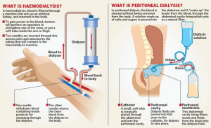 In dialysis, waste, salts and excess water are removed from the ...