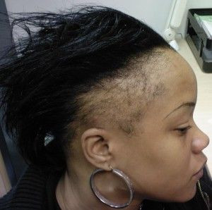 ... , Hairstyles Leaded, Hair Care, Nature Hair, Hair Loss, Black Women