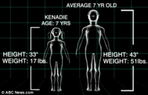 Vitals: Kenadie stands at 33 inches tall and weighs 17lbs. The average ...