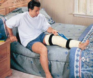 plaster leg casts for women