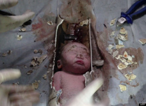Chine: un bébé jeté aux toilettes est secouru