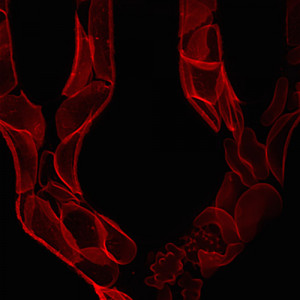 blood science microscope sickle cells confocal microscopy