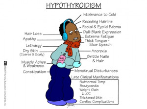 Typical manifestations of hypothyroidism