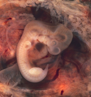Tegenstanders embryo’s in quotes