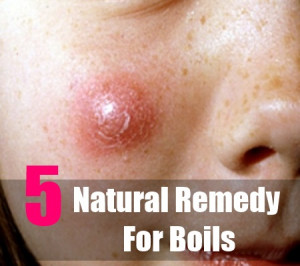 Boils On Buttocks Home Remedies