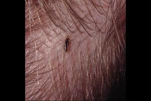 Image of Louse
