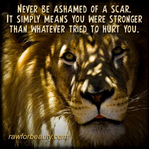 never be ashamed of a scar it simply means you were stronger then