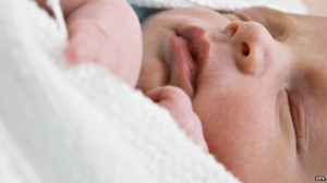 section birth 'link to later obesity'