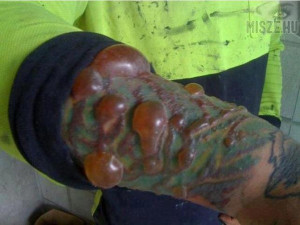 ... but can be a little bit risky whether your getting your first tattoo