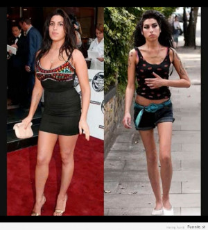 Celebrities Before & After Drugs (32 Photos)