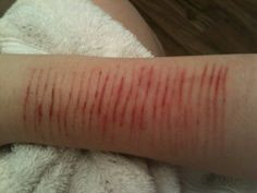 Cut On Arm Cuts on arms