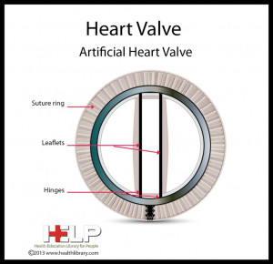 Prosthetic Heart Valves