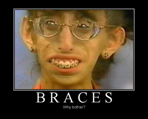 adults with braces