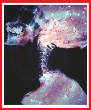 Nic Sheff Tweak Quotes http://www.glogster.com/vickieflanders/tweak ...