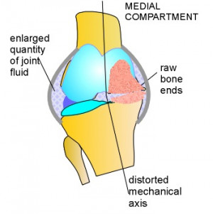 Search Results for: Knee Injury Cartoon