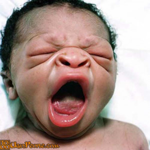 Ugly Baby With A Big Mouth