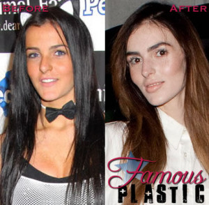 Famous Plastic - Celebrity Plastic Surgery Pictures and Celebrity C...