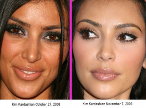 Did Kim Kardashian get plastic surgery? Before and after photos