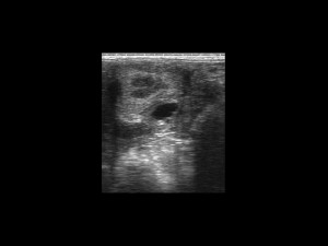 Clinical Image - Tringa Linear Vet - Equine: ovary recent ovulation