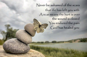 ... over the wound is closed you endured the pain god has healed you every