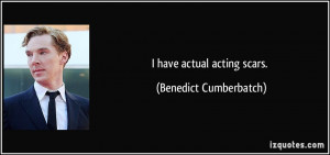 have actual acting scars. - Benedict Cumberbatch