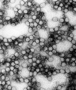 TEM micrograph of the yellow fever virus