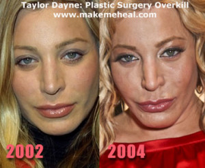 Taylor Dayne Goes Overkill With Plastic Surgery
